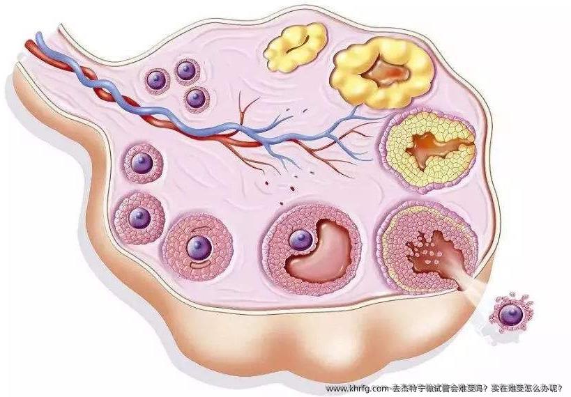 去杰特宁做试管会难受吗？实在难受怎么办呢？