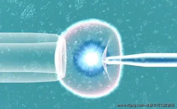 单身女性进行体外受精（IVF）的可行性与考虑因素