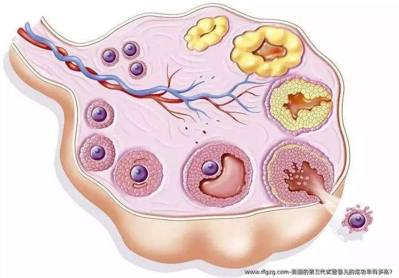 美国的第三代试管婴儿的成功率有多高？