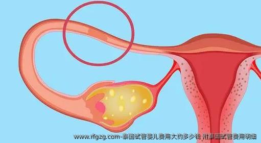 泰国试管婴儿费用大约多少钱？附泰国试管费用明细