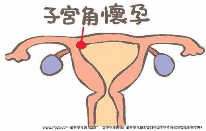 试管婴儿技术如何帮助不孕不育家庭实现生育梦想？