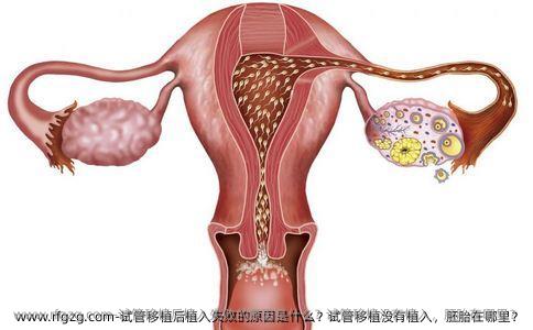 试管移植后植入失败的原因是什么？试管移植没有植入，胚胎在哪里？