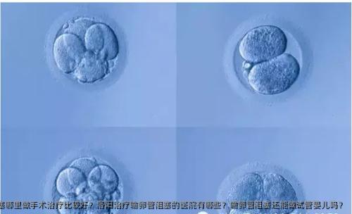 洛阳输卵管阻塞哪里做手术治疗比较好？洛阳治疗输卵管阻塞的医院有哪些？输卵管阻塞还能做试管婴儿吗？