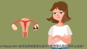 如何选择试管婴儿技术？试管婴儿技术有什么效果？