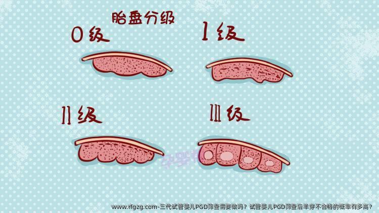 三代试管婴儿PGD筛查需要做吗？试管婴儿PGD筛查后羊穿不合格的概率有多高？