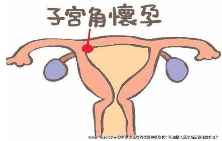 你有多少成功的试管移植症状？胚胎植入成功后应该注意什么？