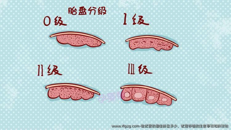 做试管的较好龄是多少?试管移植的注意事项和龄限制