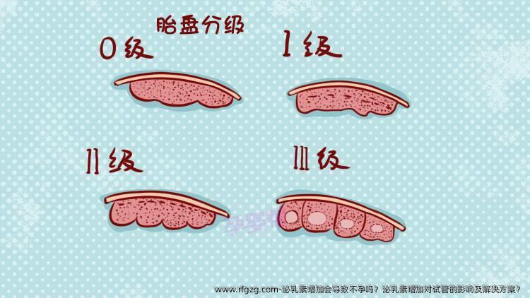 泌乳素增加会导致不孕吗？泌乳素增加对试管的影响及解决方案？