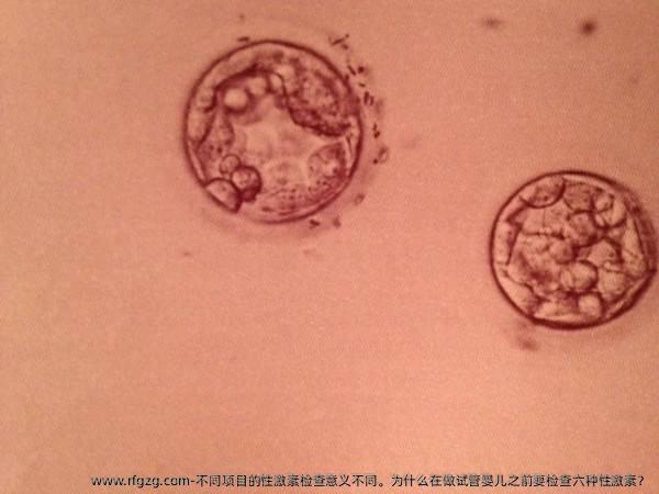 不同项目的性激素检查意义不同。为什么在做试管婴儿之前要检查六种性激素？