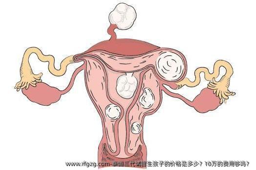 泰国三代试管生孩子的价格是多少？10万的费用够吗？